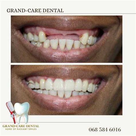 Dentist Midrand .